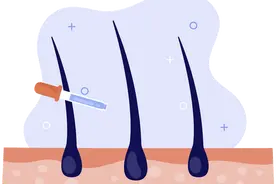 它被称为防脱发“天花板”，医生却说：你把握不住……图片