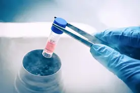 干细胞治疗糖尿病肾病前景可期图片