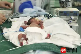 险象环生！1500克的早产宝宝一出生就小肠坏死……图片