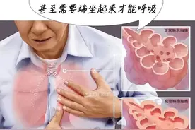 酒精、84消毒液和洁厕灵怎么选？不同的消毒液千万别这样用图片
