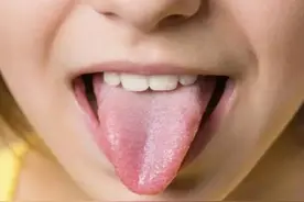 身体好坏写在舌头上，自己赶紧照镜子看看！图片