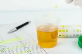 尿黄是上火？泡沫多是肾不好？关于尿的健康知识，还是得了解一些图片