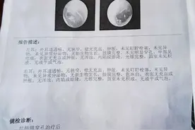 一学生被教练扇巴掌致耳膜穿孔！学校回应图片