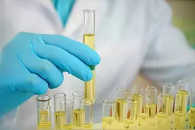 晨起第一泡尿黄、尿分叉、泡沫多，是肾有问题吗？看完心里有数了图片