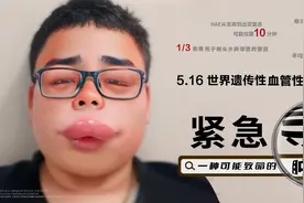 请大家扩散，紧急寻找这“肿”人！图片