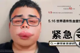 寻找这种可能致命的肿 让患者尽早接受规范化治疗图片