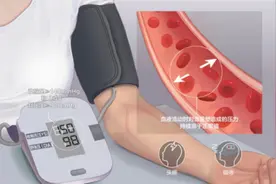24岁小伙竟有两年高血压病史！压力大、常吃夜宵都是原因图片