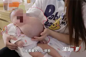 产检发现孩子有问题 你会留下吗？图片