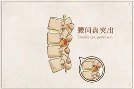 都是腰椎间盘，为啥就我的那么“突出”？图片