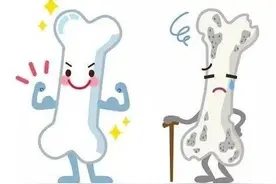 骨质疏松的“前哨兵”—双能X射线骨密度检测丨贤医健康说图片