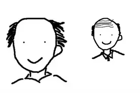 斑秃、全秃、普秃？华西专家说，管你啥子秃，搞快来看医生才是最稳当！图片