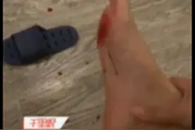 惊悚！酒店拖鞋内竟暗藏刀片，顾客被划伤狂流血；网友：藏刀片的人心理得多阴暗图片