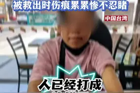 印尼籍女看护被虐待监禁9个月 被救出时伤痕累累图片