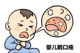 新生儿为什么会感染鹅口疮？图片
