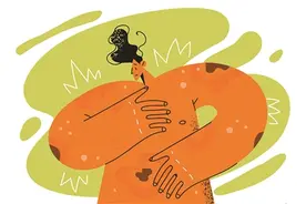 半年都不消停？你的湿疹“不一般”图片