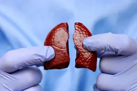 结节、增生、囊肿……体检报告的高频词，到底意味着什么？一文读懂！图片