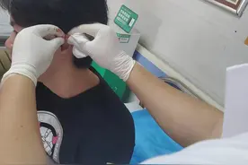 道县中医医院：放血疗法治疗高热不退有奇效图片