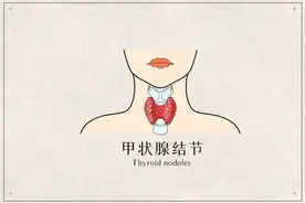 查出甲状腺结节，会癌变吗？教你看懂超声报告！图片