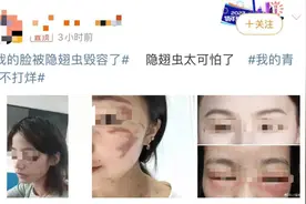 热搜第一！毒液堪比硫酸，有人差点毁容……台州也有图片