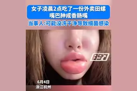 女生半夜嗦田螺肿成“香肠嘴”，网友：终于有人超越梁朝伟的“香肠嘴”了图片