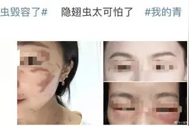 遇到这种虫子千万别打，有人差点毁容！浙江多地都有出没图片