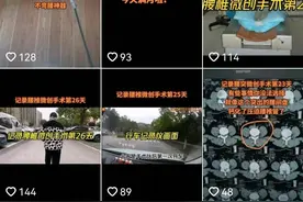 32岁设计师分享腰椎手术康复日记，呼吁年轻人注意护腰图片
