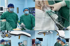 胶州：单孔腹腔镜胆囊切除术让“无疤痕”手术成为现实图片