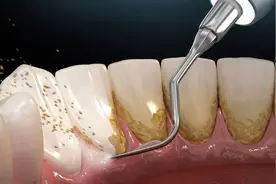 不做这件事，你的牙可能永远都是脏的！（不是刷牙图片