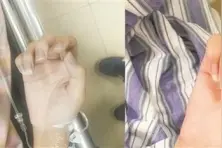 误食干燥剂女孩中毒 医生提醒:干燥剂暗藏危险图片