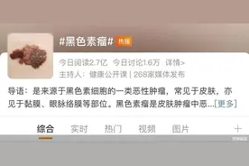 知名歌手患黑色素瘤去世，警惕这样的“痣”！图片