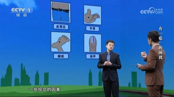 自查！痣长在这些位置千万别大意！