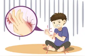 手上长水疱了？别抓！去治！图片