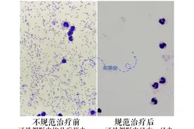 可致命！这里发现一例重症图片