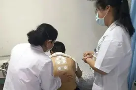 冬病夏治，宁阳县第一人民医院“三伏贴”来啦图片