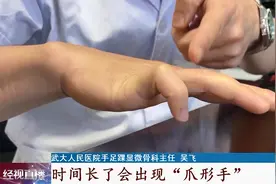 别再这样睡午觉！小学生睡醒被送上手术台，只因这个姿势图片