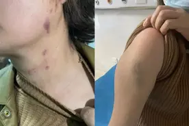 女子因邻里纠纷求助村支书反被打伤？警方已介入图片