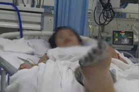 女孩充电时玩手机“被电击”，面临截肢图片