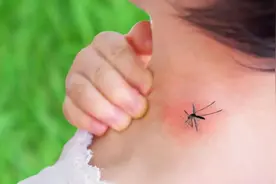 被蚊子咬了很痒，怎么快速止痒？图片