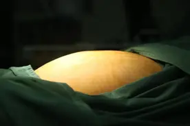 16岁少女突然肚大如球，医生提醒：女生要重视这件事……图片