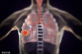 体检发现肺结节并不可怕，定期复查很重要！图片