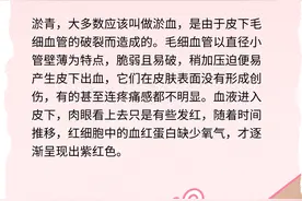 漫画科普：皮厚有什么好处——防磕碰！图片