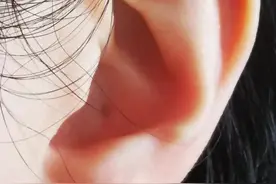 耳垂有这道折，是心梗征兆？对镜自查慌了，医生说……图片