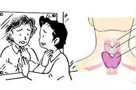 手把手教您 “甲状腺”如何自检？图片