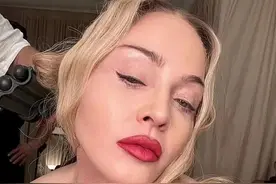 太突然！64岁麦当娜被紧急送往ICU……图片