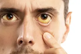 有这些特征的人，身体可能不太好！从头到脚列清楚了！图片