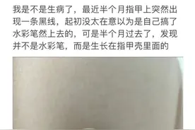 热闻|指甲上突然长了一条黑线上热搜！网友慌了！长这几种指甲的人注意图片
