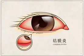 1小时接诊3例，多是孩子！医生提醒：此病已进入高发季图片