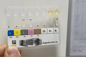 五旬女子O型血突然“变”成A型血，专家这样解释图片