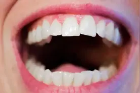 少一颗牙，多一颗牙，都会让大脑老化？图片