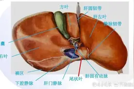 惊！女子体内巨大瘤体被血管包绕！机器人辅助微创手术成功切除图片